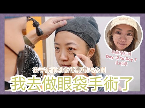 ♥ BYEBYE眼袋 ♥ 我去韓國做眼袋手術了🇰🇷從手術前到術後康復大公開👩🏽‍⚕️DAY -2～DAY 7超真實全紀錄🗒️ || Dottie Hidee ||