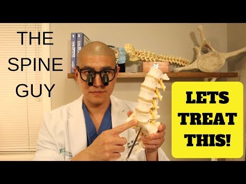 How a Spine Doctor Treats Lumbar Disc Herniations