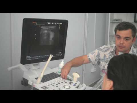 Поставка УЗ-сканера Samsung Medison SonoAce R7 (медицинский центр Ситилаб, г. Самара)