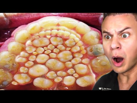 Orthodontist Reacts To Horrifying Dental TikToks