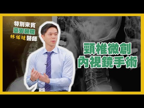 健康新知2022 - 頸椎微創內視鏡手術