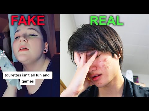 Guy with Real Tourettes Reacts to Tiktoker Faking Tourettes