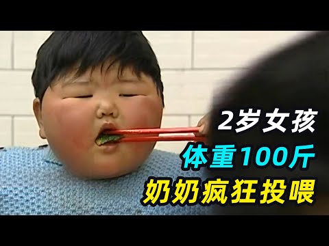 2岁女孩体重100斤！奶奶还觉得很可爱，医生：离死不远了！