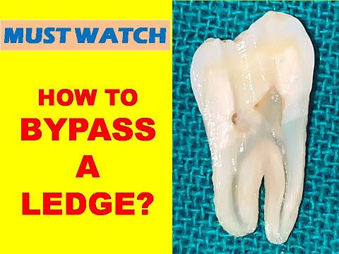 How to Bypass A Ledge?? (With Subtitles)