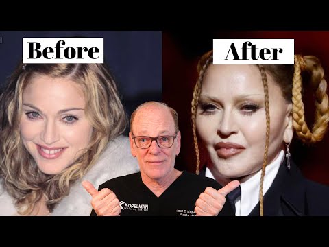 Madonna's Plastic Surgery Transformation | What Really Happened?!