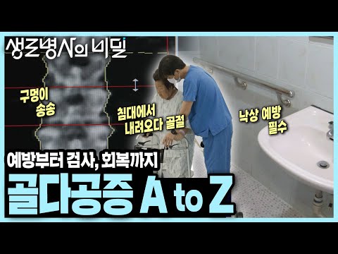 [본방 종합] 증상과 통증 없이 어느새 몸을 무너뜨리는 골다공증, 예방부터 치료·회복까지 AtoZ I 뼈가 무너지면 몸도 무너진다, 골다공증 I KBS 250305 방송