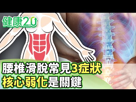 腰椎滑脫常見扭傷、拉傷、挫傷 核心弱化是關鍵【健康2.0分段】@tvbshealth20 EP3103-2 20251011 #陳欣湄#韋汝#花世源#侯鐘堡#沈瑞斌#鄭雲龍