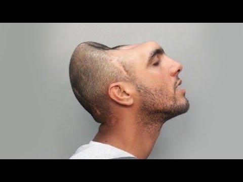 People Who Survived Freak Accidents