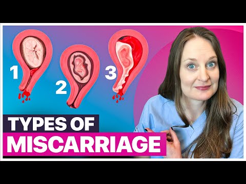 10 Kinds of Miscarriages: Understanding the Difference and Why It Matters