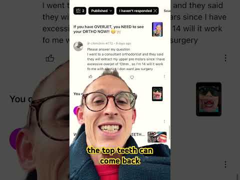 Will upper extractions fix my 12mm overbite(overjet)? @-chimchim-4772 #teeth #extraction #dentist