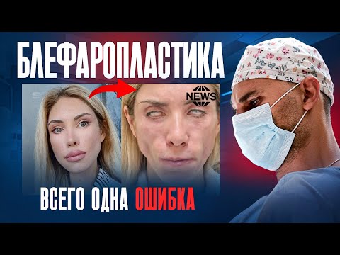 САМАЯ коварная операция! | О чем МОЛЧАТ хирурги?