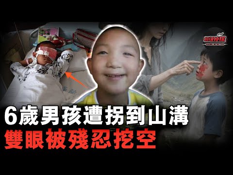 親伯母活活挖出6歲男孩雙眼，事後跳井自我了結，失明男孩現狀如何？【超級偵探】懸疑推理｜案件解說