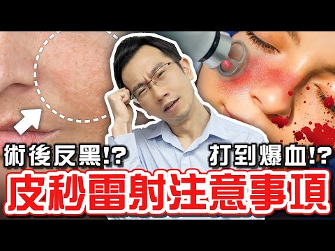 皮秒雷射打到出血才有效? 術後反黑怎麼辦?