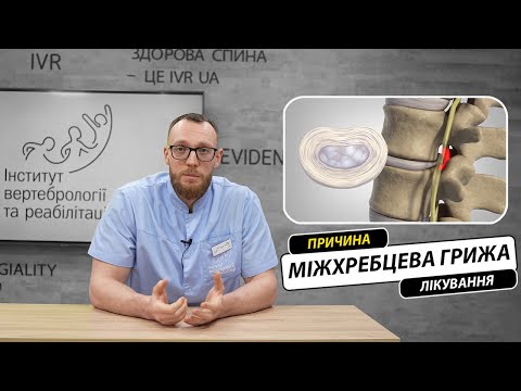Міжхребцева грижа?  Чому виникає? Як лікувати? Яка профілактика міжхребцевої кили?