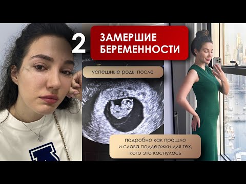 Моя история 2х замерших беременностей. Для тех, кто пережил подобный опыт + выводы и слова поддержки