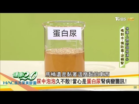 尿中泡泡久不散?當心是「蛋白尿」腎病變警訊!健康2.0