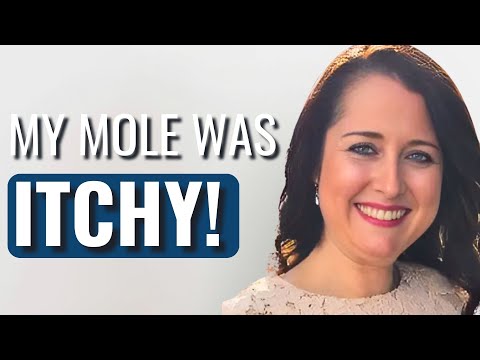 Itchy, Weird Mole To STAGE 4 CANCER! - Megan | Stage 4 Melanoma | The Patient Story