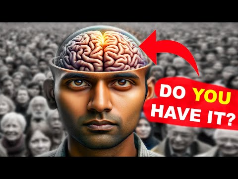 Why There Are Only 50 People in the World With This Type of Brain