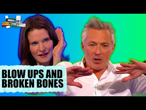 Injury Stories That Shouldn’t Be Funny… But Are 😭 | Would I Lie To You?