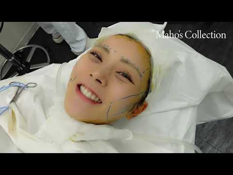 【前編】湘南美容外科クリニックで整形手術をしてきたので全てを公開します