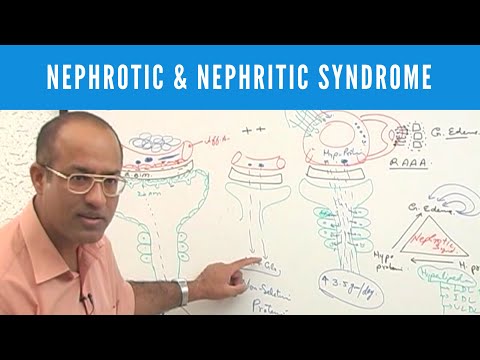 Nephrotic and Nephritic Syndrome | Causes Symptoms & Treatment🩺