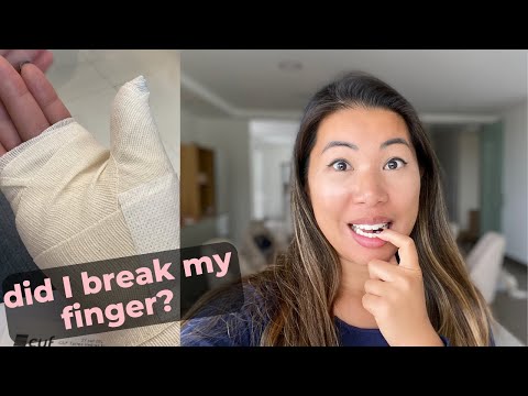 I Went To The Emergency Room/ CUF Torres Vedras/ An Americans Experience w Portugal Private Hospital