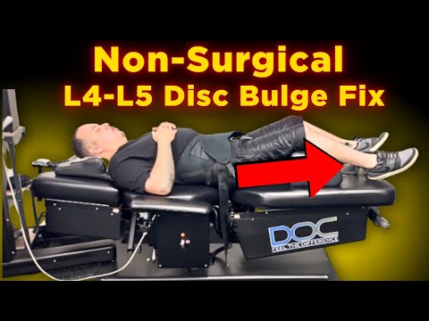 How to Fix a Disc Bulge Without Surgery (L4-L5 & L5-S1 Explained) | Dr. Tam Ly