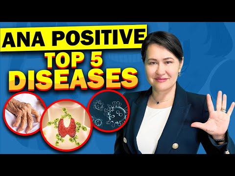 Top 5 Diseases with A Positive ANA (Antinuclear Antibodies) Test