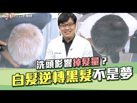 白髮變黑不是夢！4招養出「烏黑秀髮」洗頭影響掉髮量？皮膚科名醫曝關鍵｜台灣髮王皮膚專科醫徐常捷｜主持人許晶晶｜奕起聊健康｜祝你健康