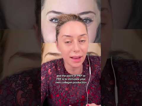 PRP Under Eyes #shorts