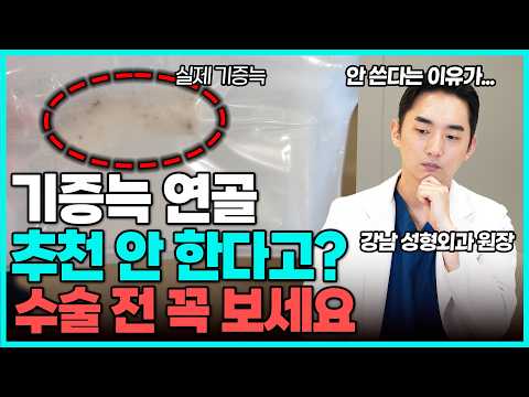 코 첫 수술 기증늑 연골 쓰지말라고? 강남 성형외과 원장이 말하는 기증늑 제대로 사용하는 방법