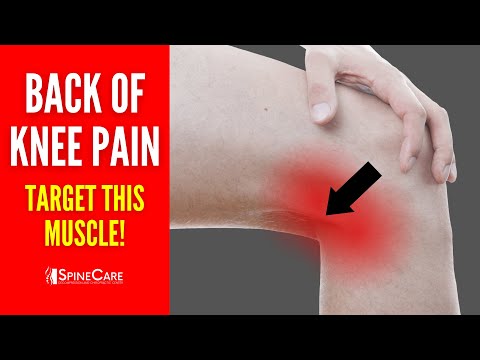 How to Instantly Relieve Popliteus Pain (BACK OF KNEE PAIN)