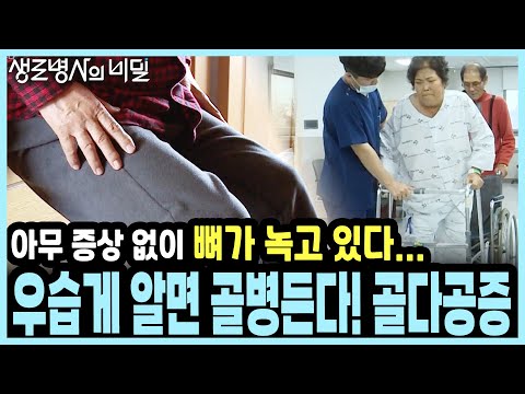 증상이 없어서 더 무섭다! 소리 없이 뼈 녹이는 '시한폭탄' 골다공증의 정체 I KBS 20181128 방송