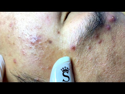 Relax Every Day With Sac Dep Spa #0167