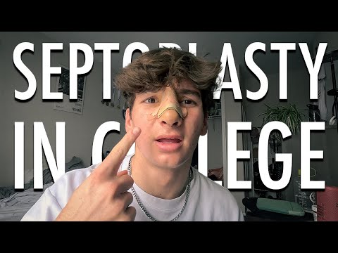 SEPTOPLASTY & recovery while in COLLEGE