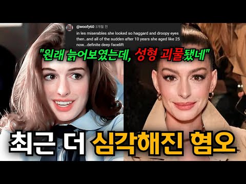 완벽한 여배우의 저주... 앤 헤서웨이에 대한 혐오가 선을 넘은 진짜 이유