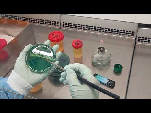 Выделение чистой культуры аэробов. 1 этап