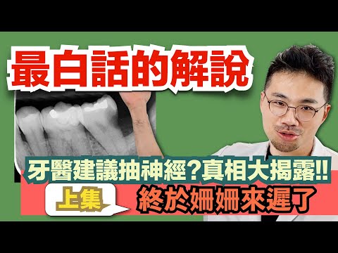 【史上最白話的抽神經解密(上)終於姍姍來遲了！】什麼時候需要抽神經？什麼時候需要根管治療？可不可以不要抽補起來就好？說到底抽神經到底在抽什麼？為什麼要抽它？看完這集，你也能成為根管治療小博士！！！