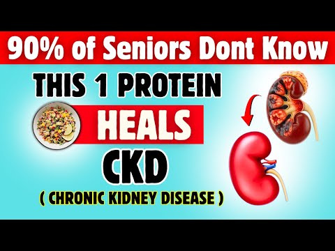 Top Nephrologist Reveals the BEST Protein Sources for Kidney Health & CKD