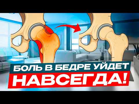 Боль в бедре сбоку.Трохантерит? Что делать? Лечение или упражнение.