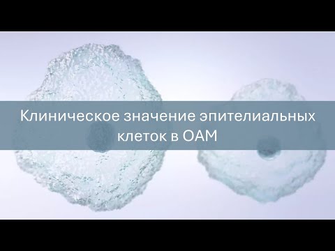 Клиническое значение эпителиальных клеток в ОАМ