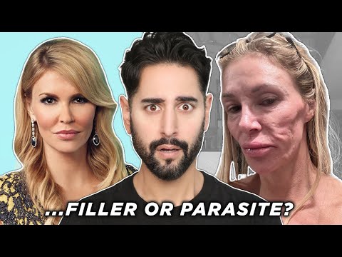 Botched Filler, Parasite Or...Nair?! What Happened to Brandy Glanville's Face?
