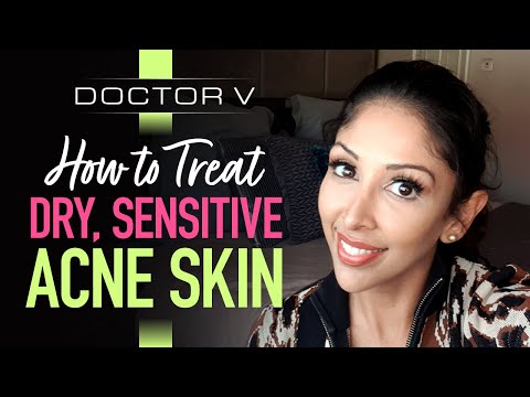 Doctor V: How to Treat Dry, Sensitive, Acne, Skin | Brown/ Black Skin of colour | SOC | DR V