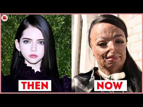 20 Black Celebs and Their Shocking Cosmetic Transformations | Then and Now 2026