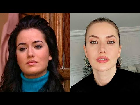 TOP 20 Turkish Actresses Before and After Plastic Surgery