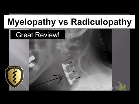 Myelopathy vs Radiculopathy - Great Review!