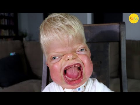 Michael the Miracle (The Boy Doctors Said Wouldn’t Survive)