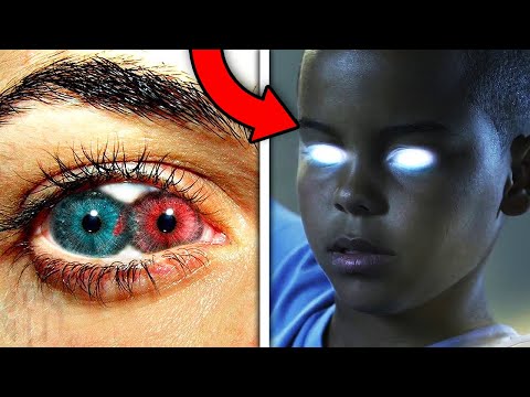 People Who Gained Real Superpowers After An Accident