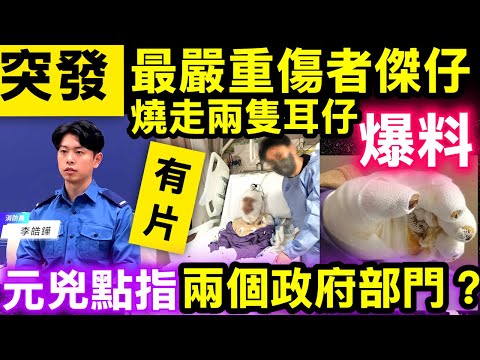 突發有片 宏福苑大火｜留醫傷者「傑仔」恐失雙耳幸保聽覺　火海逃生謝消防 消防員李皓鏵憶述救人經過 最少兩個政府部門要負責? Smart Travel《即時娛樂》  「傑仔」爬火海求生！
