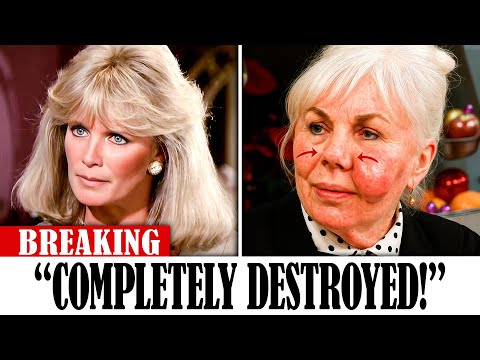 9 Golden Age Stars Who RUINED Their Faces with Plastic Surgery